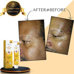 Tag recede Bees Treatment Spray