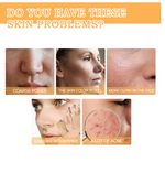 Eelhoe - Glycolic Acid 7% Toning Solution