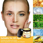 Bee Skin Elixir – Natural Bee Venom & Herbal Acne Cream for Clear Skin